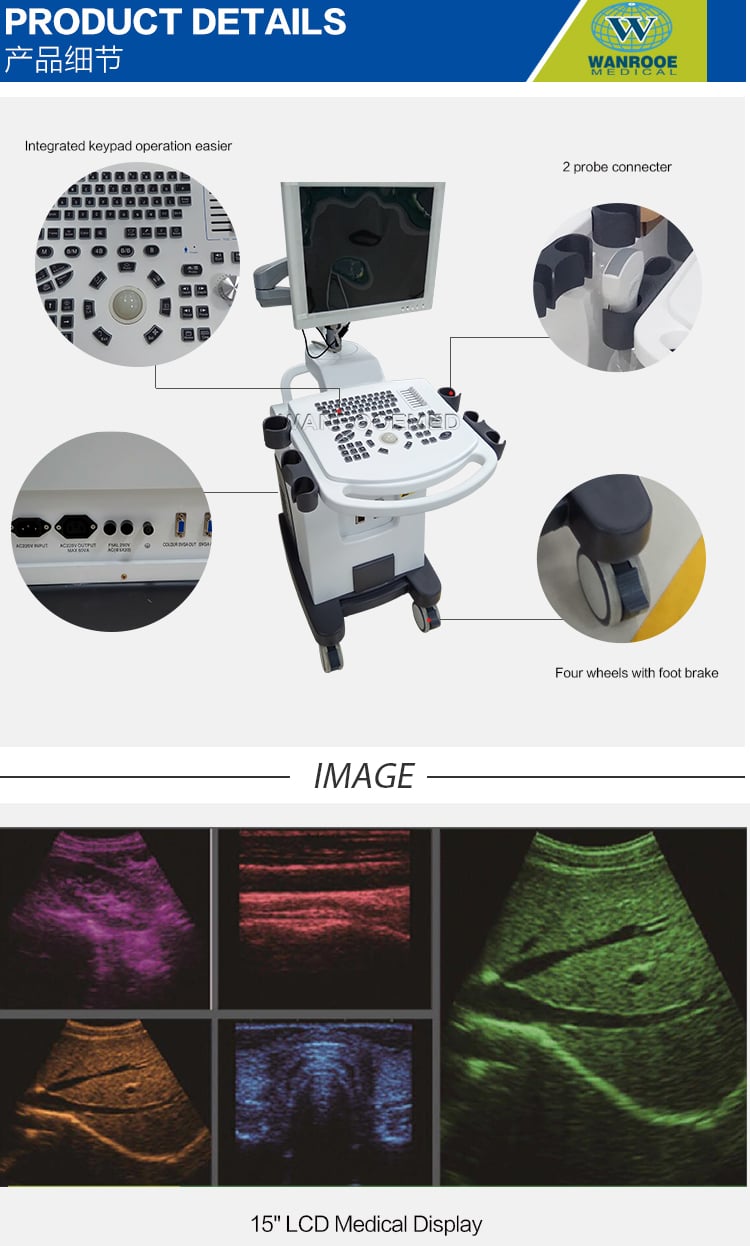 Ultrasound Scanner, Laptop Ultrasound Scanner, Portable Ultrasound Machine, Fetal Doppler Ultrasound, Color Doppler Ultrasound Machine 