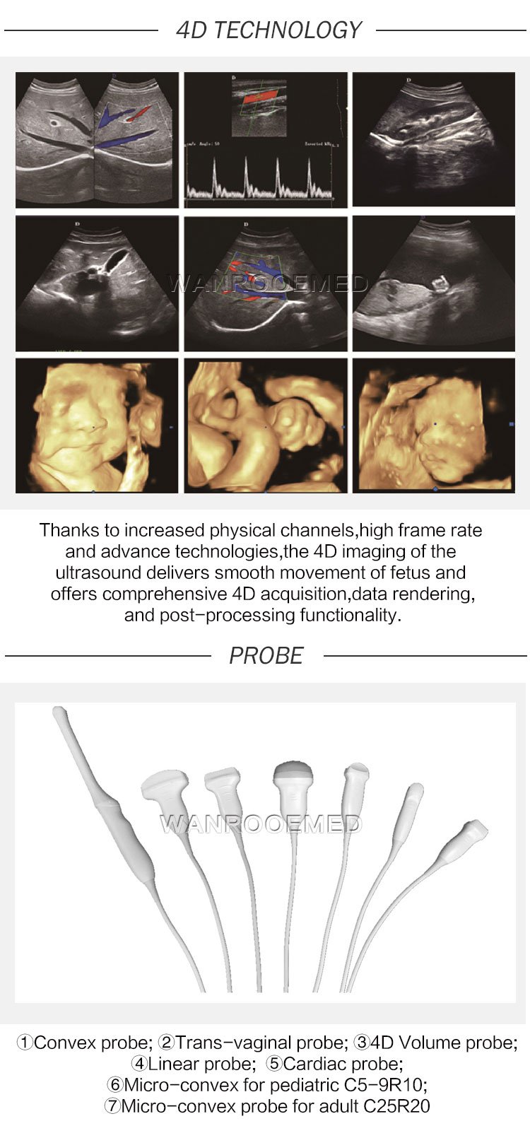 Trolley Ultrasound Machine, 4D Color Doppler, Ultrasonic Diagnostic, Trolley 4D Doppler, Ultrasound Machine