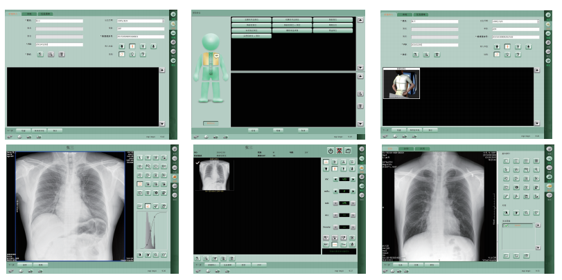 DR system,full body x ray machine,x ray imaging equipment 