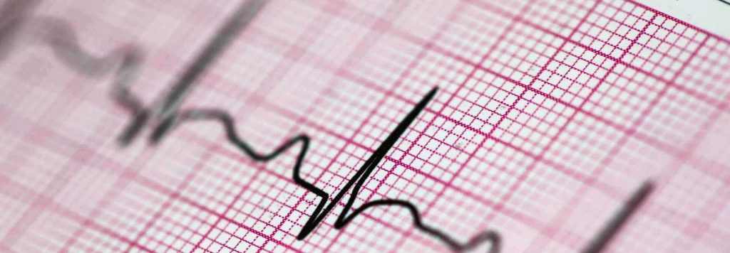 Are ecg and ekg the same,ECG device,EKG