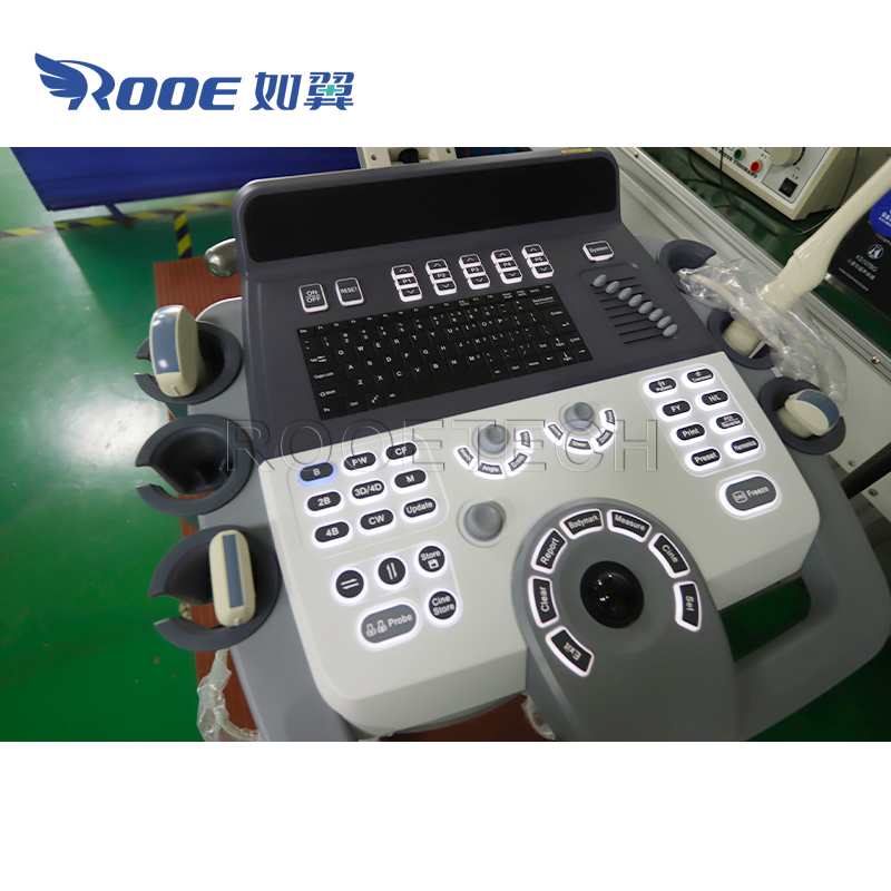Ultrasound Scanner,Color Doppler Ultrasound,Ultrasound Diagnostic system