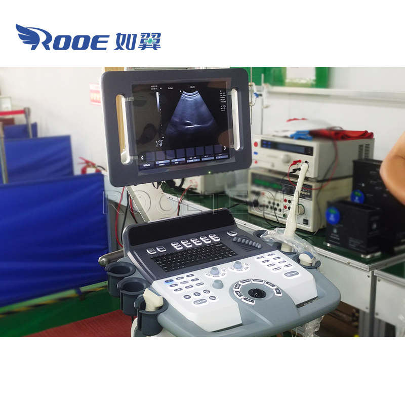 Ultrasound Scanner,Color Doppler Ultrasound,Ultrasound Diagnostic system