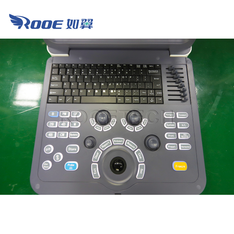 Portable Ultrasound Scanner,Ultrasound Diagnostic System,Color Doppler Ultrasound