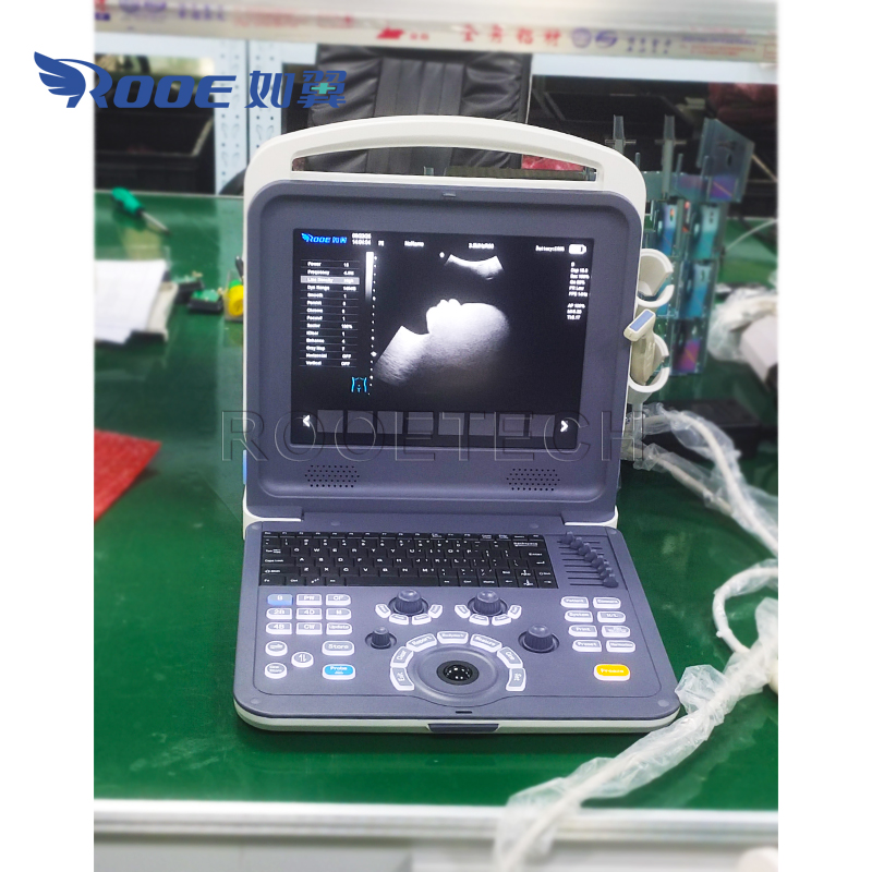 Portable Ultrasound Scanner,Ultrasound Diagnostic System,Color Doppler Ultrasound