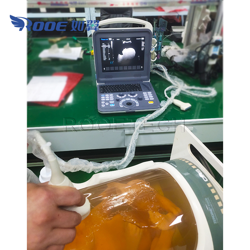Portable Ultrasound Scanner,Ultrasound Diagnostic System,Color Doppler Ultrasound