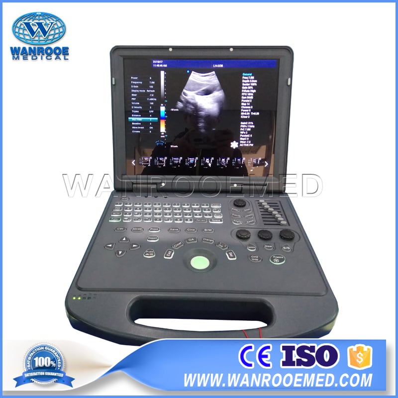 Ultrasound Scanner, Laptop Ultrasound Scanner, Portable Ultrasound Machine, Fetal Doppler Ultrasound, Color Doppler Ultrasound Machine Price