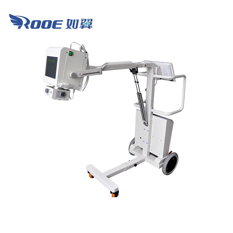 portable digital x ray machine,dr mobile x ray machine,mobile x ray equipment