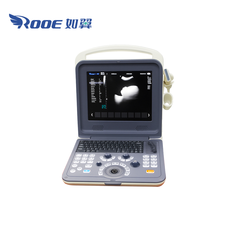 Portable Ultrasound Scanner,Ultrasound Diagnostic System,Color Doppler Ultrasound