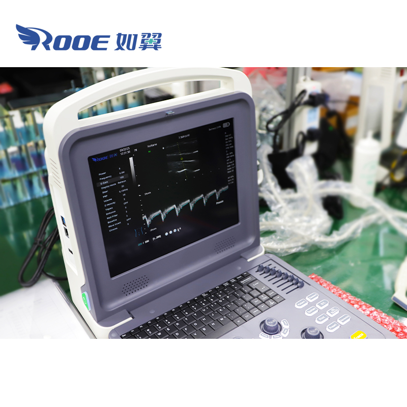 Portable Ultrasound Scanner,Ultrasound Diagnostic System,Color Doppler Ultrasound