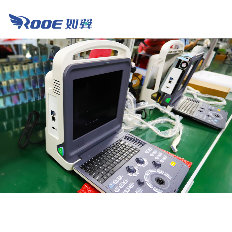 Portable Ultrasound Scanner,Ultrasound Diagnostic System,Color Doppler Ultrasound